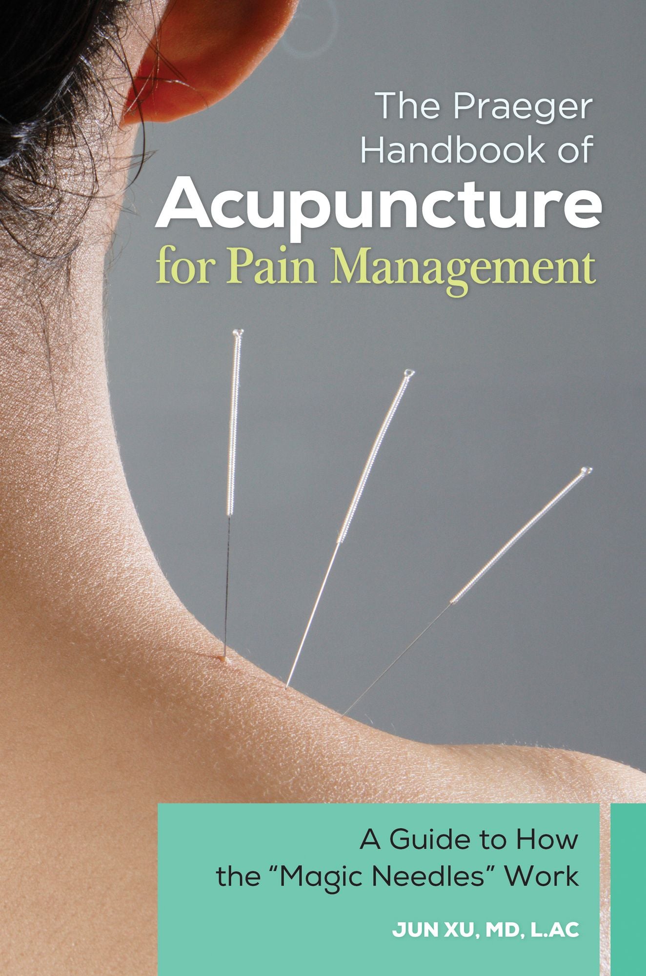 The Praeger Handbook of Acupuncture for Pain Management: A Guide to How the "Magic Needles" Work: A Guide to How the "Magic Needles" Work