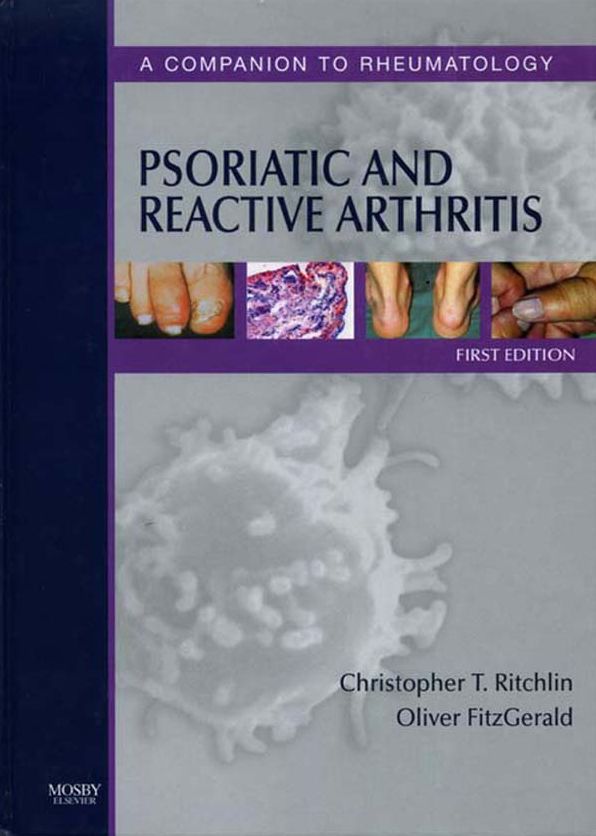 Psoriatic and Reactive Arthritis E-Book: A Companion to Rheumatology