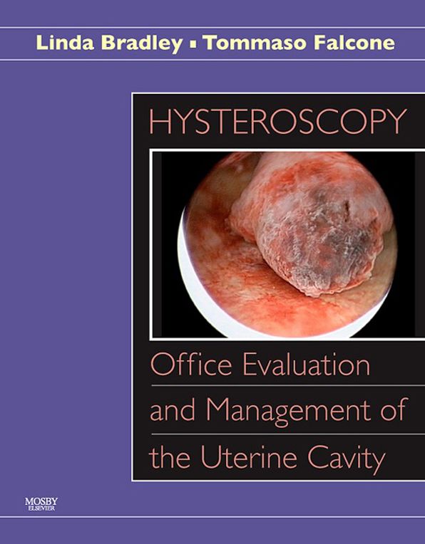 Hysteroscopy: Office Evaluation and Management of the Uterine Cavity E-Book: Text