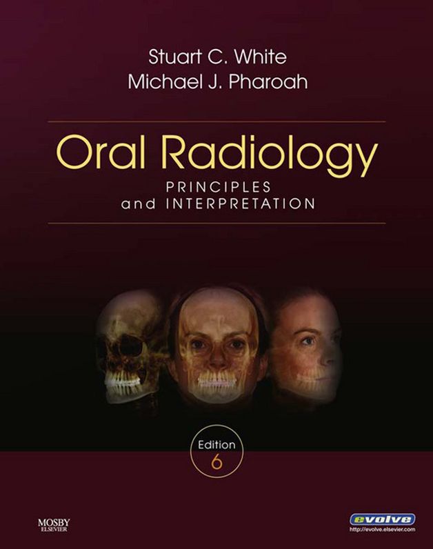 Oral Radiology - E-Book: Principles and Interpretation