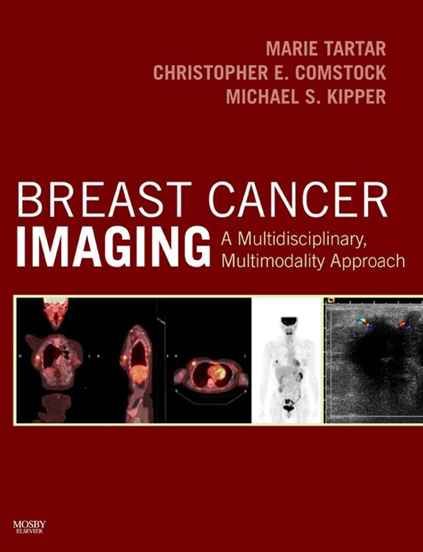 Breast Cancer Imaging E-Book: A Multidisciplinary, Multimodality Approach