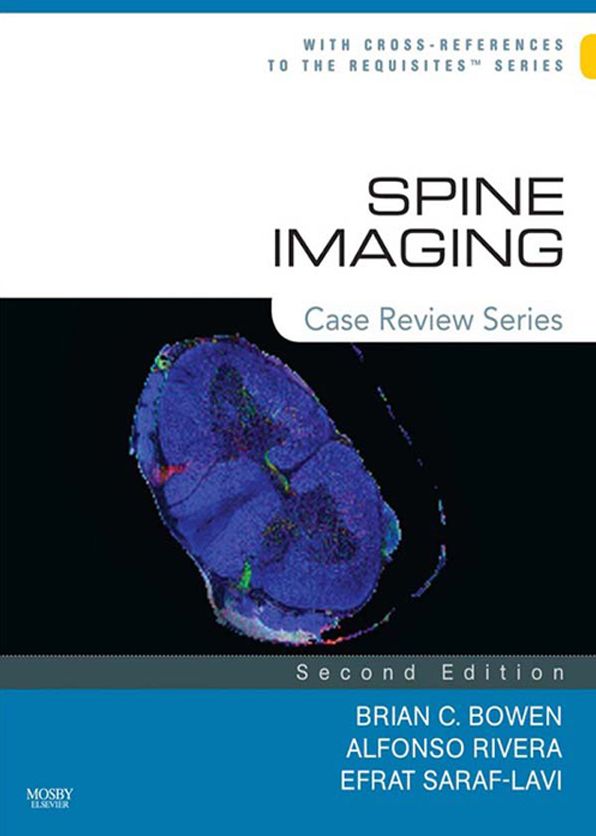 Spine Imaging E-Book: Case Review Series