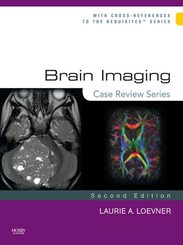 Brain Imaging: Case Review Series E-Book