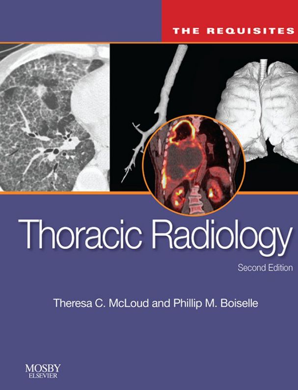 Thoracic Radiology: The Requisites E-Book