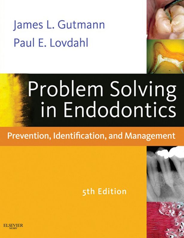 Problem Solving in Endodontics - E-Book: Prevention, Identification and Management