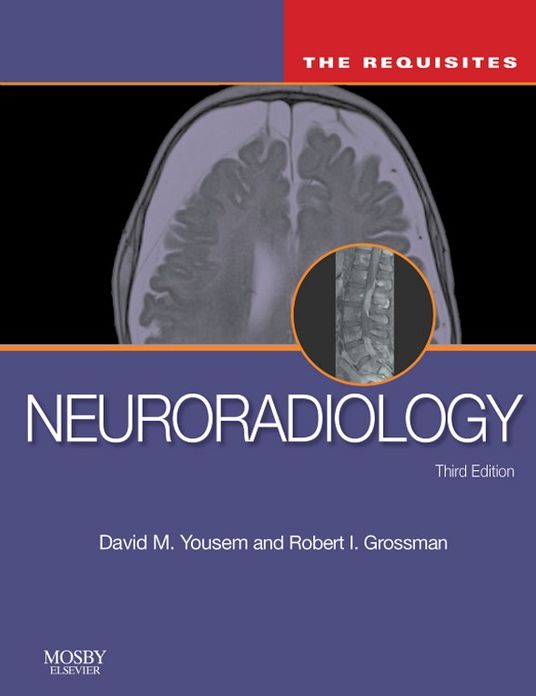 Neuroradiology: The Requisites E-Book