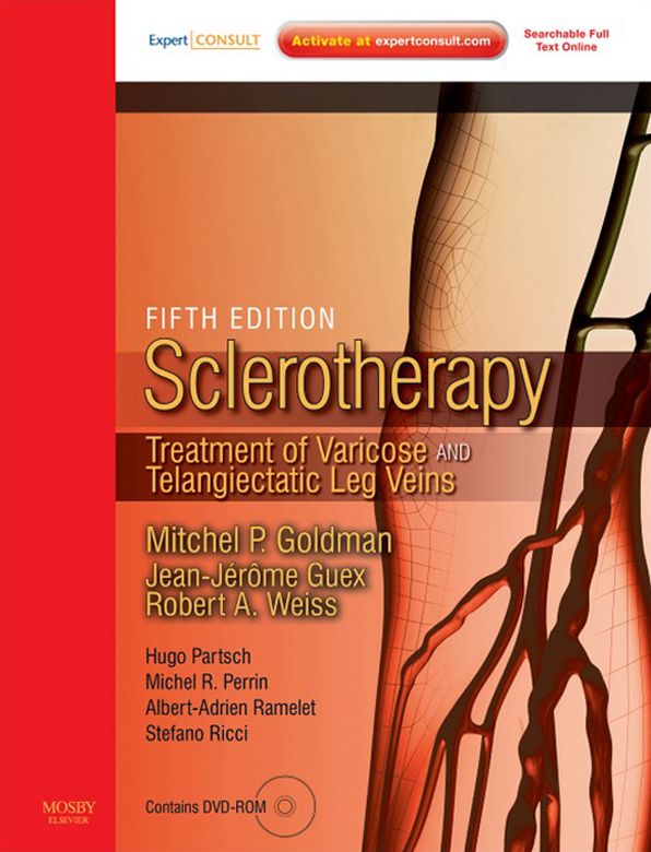 Sclerotherapy E-Book: Treatment of Varicose and Telangiectatic Leg Veins