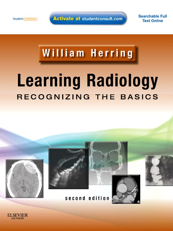 Learning Radiology: Recognizing the Basics with STUDENT CONSULT Online Access, 2nd edition