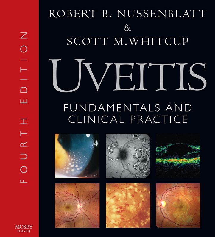 Uveitis E-Book: Fundamentals and Clinical Practice