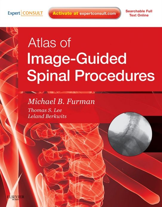 Atlas of Image-Guided Spinal Procedures E-Book