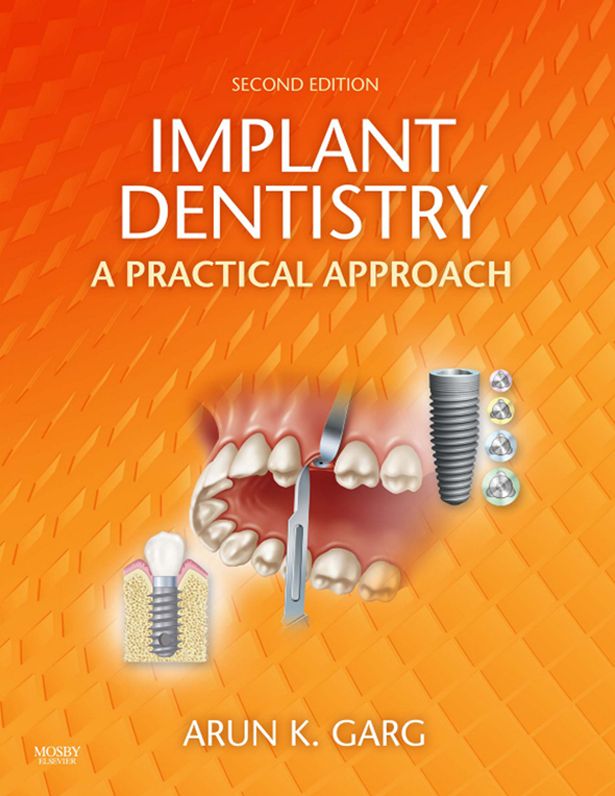Implant Dentistry - E-Book