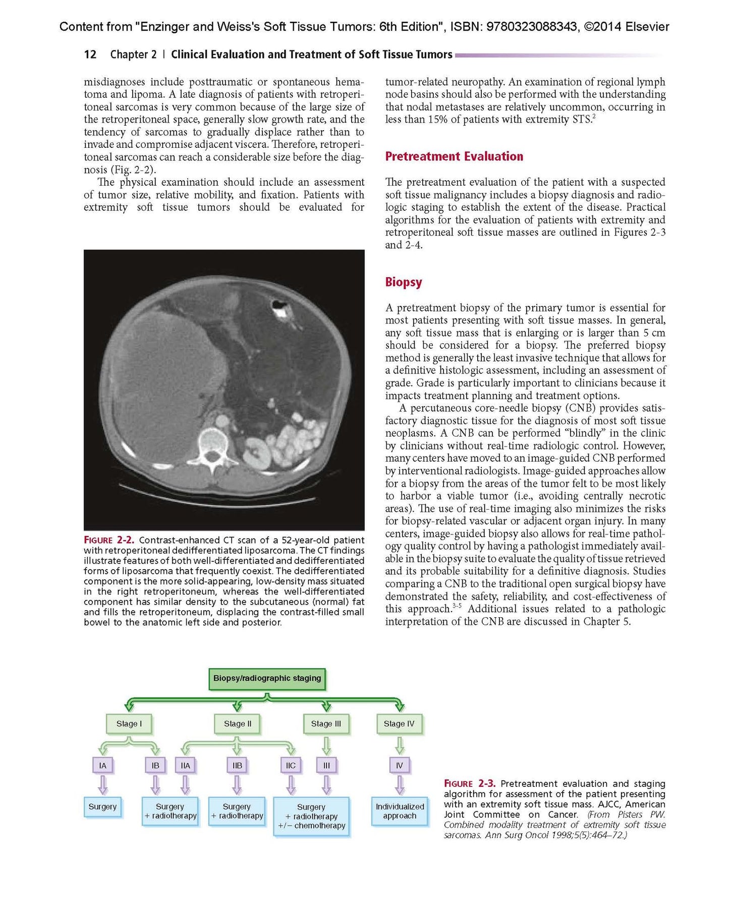Enzinger and Weiss's Soft Tissue Tumors: Expert Consult: Online and Print