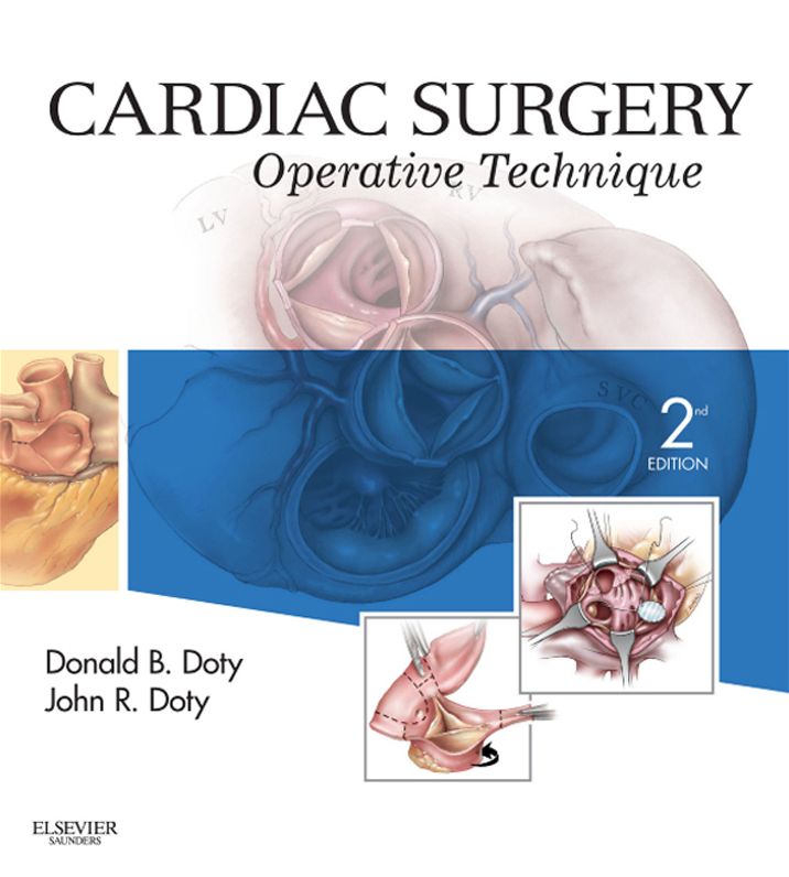 Cardiac Surgery E-Book: Operative and Evolving Technique