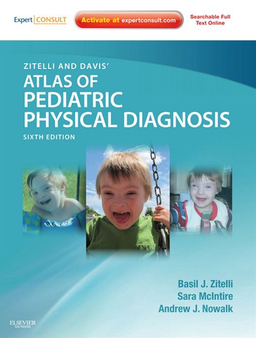 Zitelli and Davis' Atlas of Pediatric Physical Diagnosis E-Book: Expert Consult - Online