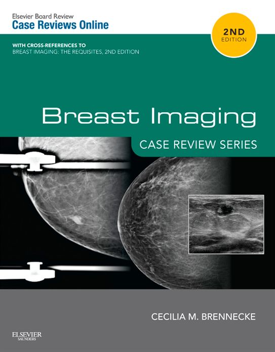 Breast Imaging: Case Review Series E-Book