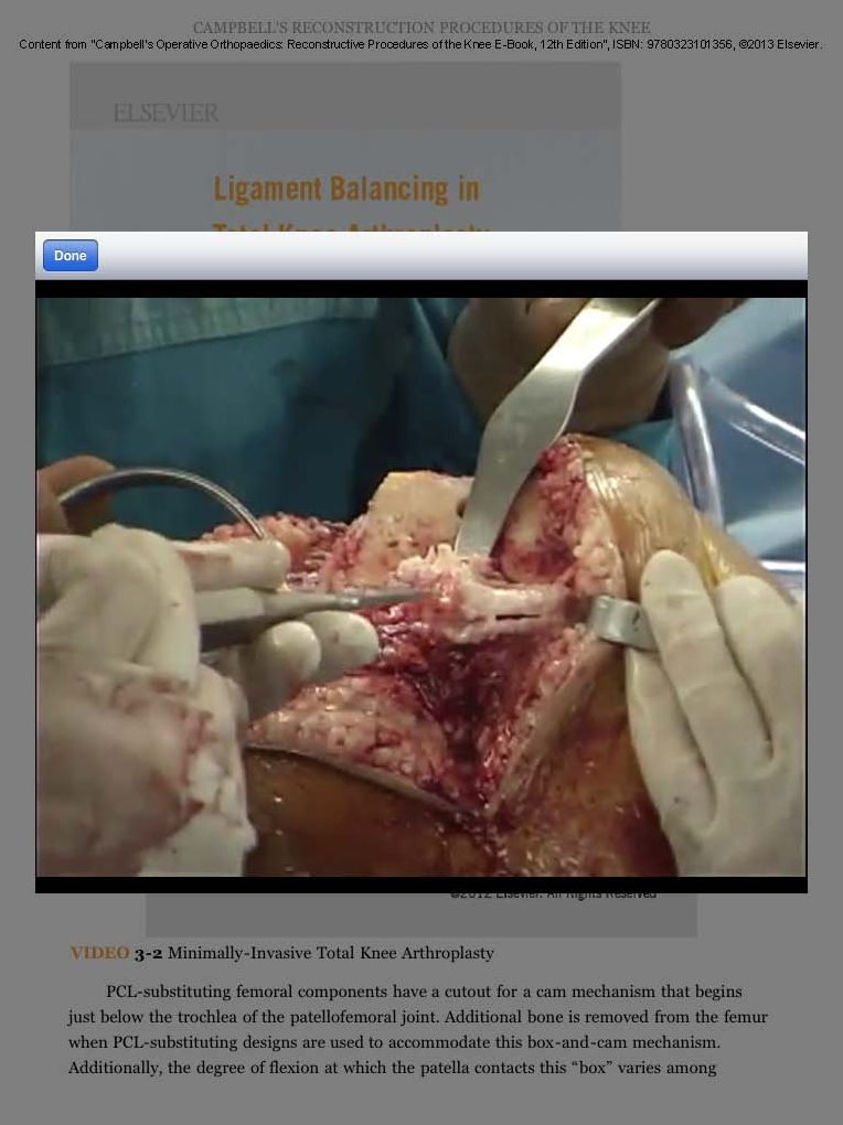 Campbell's Operative Orthopaedics: Reconstructive Procedures of the Knee E-Book