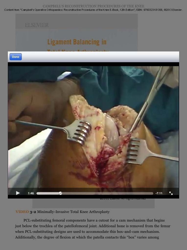 Campbell's Operative Orthopaedics: Reconstructive Procedures of the Knee E-Book