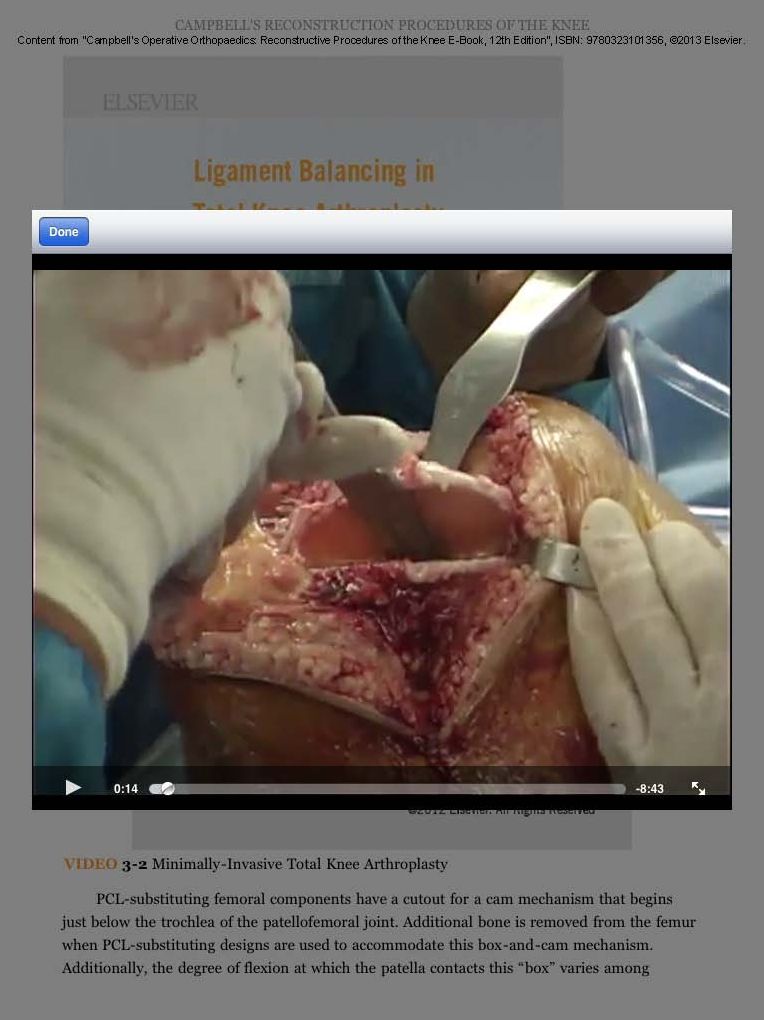 Campbell's Operative Orthopaedics: Reconstructive Procedures of the Knee E-Book