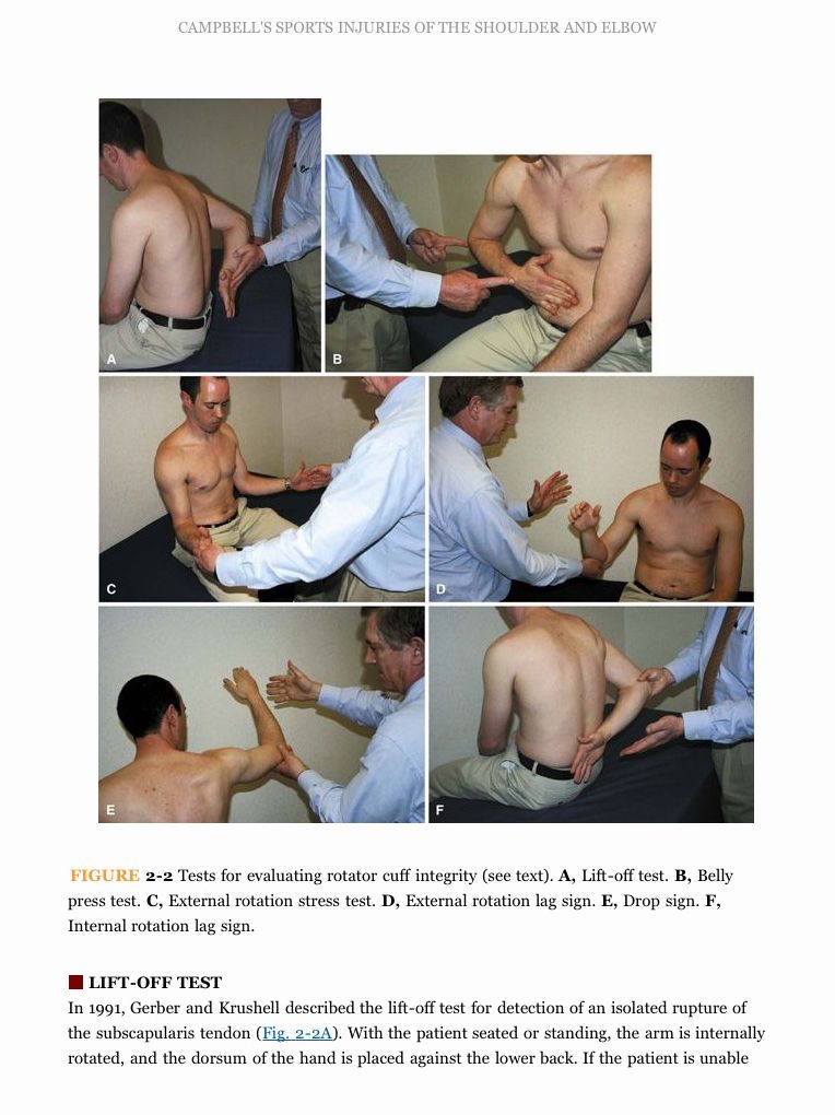 Campbell's Operative Orthopaedics: Sports Injuries of the Shoulder and Elbow E-Book