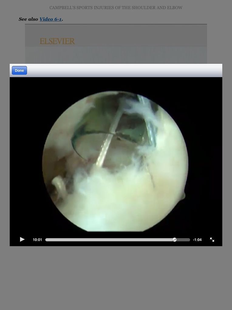 Campbell's Operative Orthopaedics: Sports Injuries of the Shoulder and Elbow E-Book