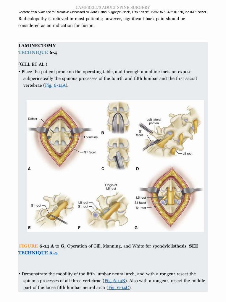 Campbell's Operative Orthopaedics: Adult Spine Surgery E-Book