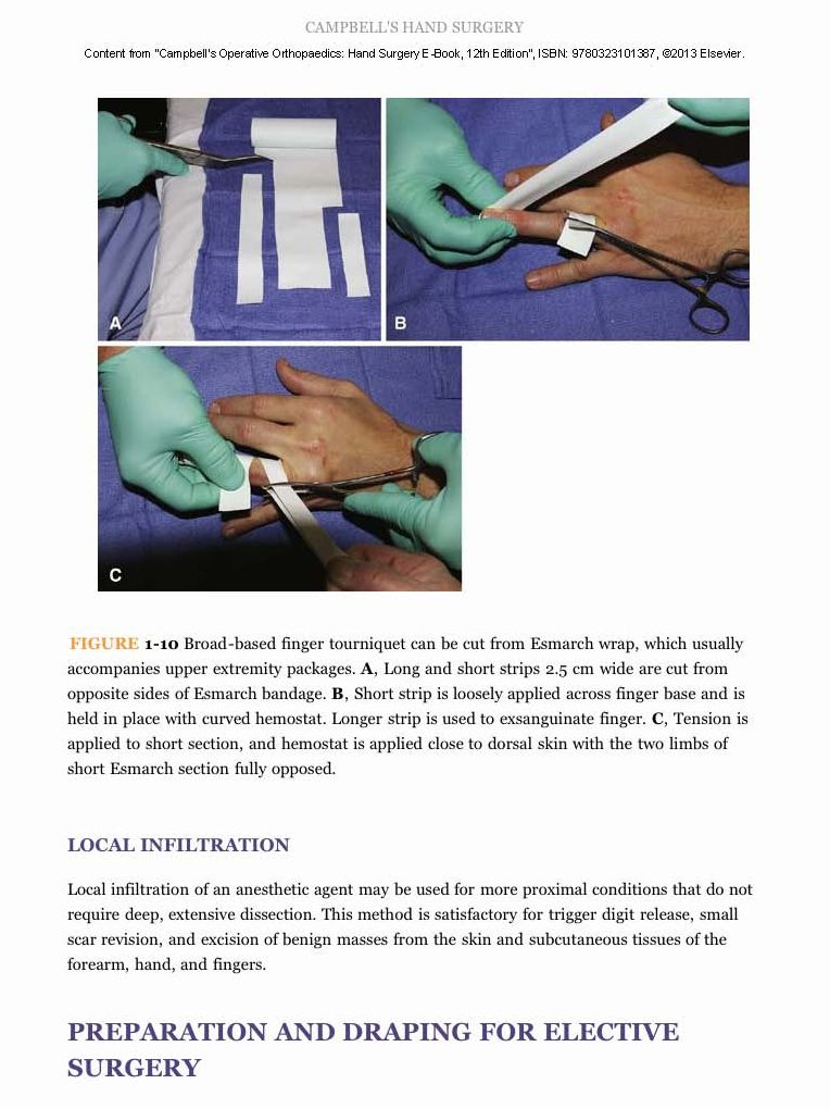 Campbell's Operative Orthopaedics: Hand Surgery E-Book