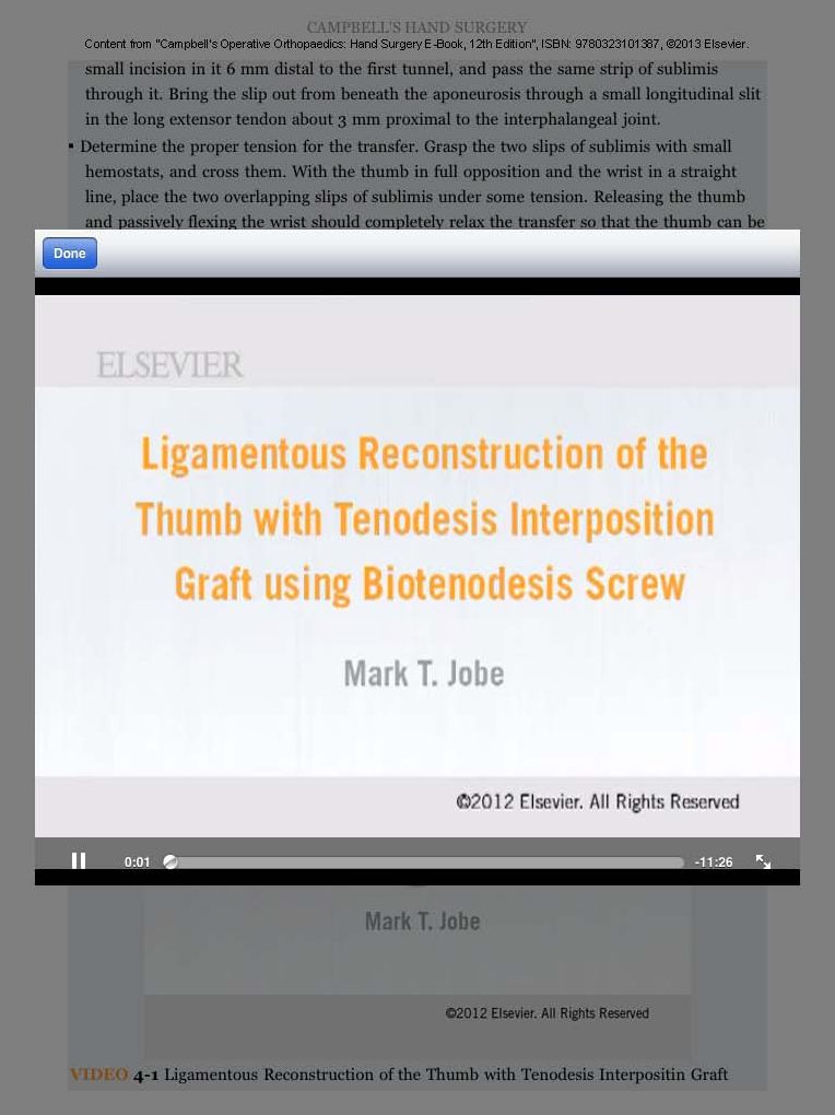 Campbell's Operative Orthopaedics: Hand Surgery E-Book
