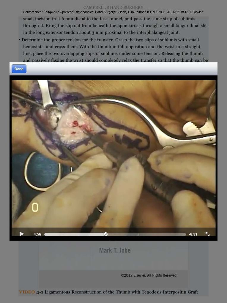 Campbell's Operative Orthopaedics: Hand Surgery E-Book