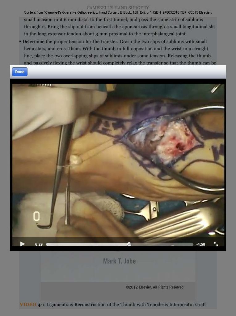 Campbell's Operative Orthopaedics: Hand Surgery E-Book