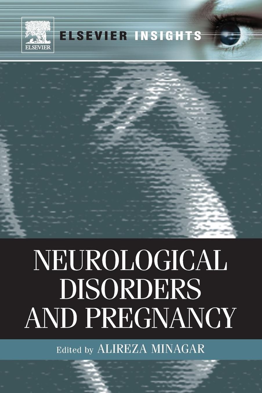 Neurological Disorders and Pregnancy