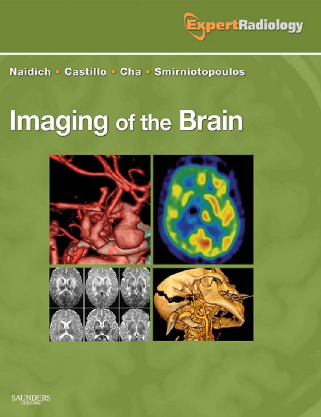 Imaging of the Brain E-Book: Expert Radiology Series