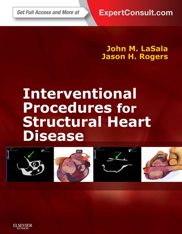 Interventional Procedures for Adult Structural Heart Disease E-Book: Expert Consult - Online