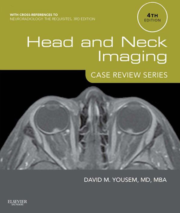 Head and Neck Imaging: Case Review Series E-Book