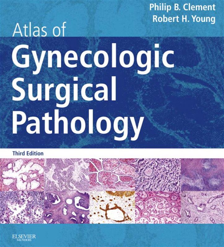 Atlas of Gynecologic Surgical Pathology E-Book: Expert Consult: Online