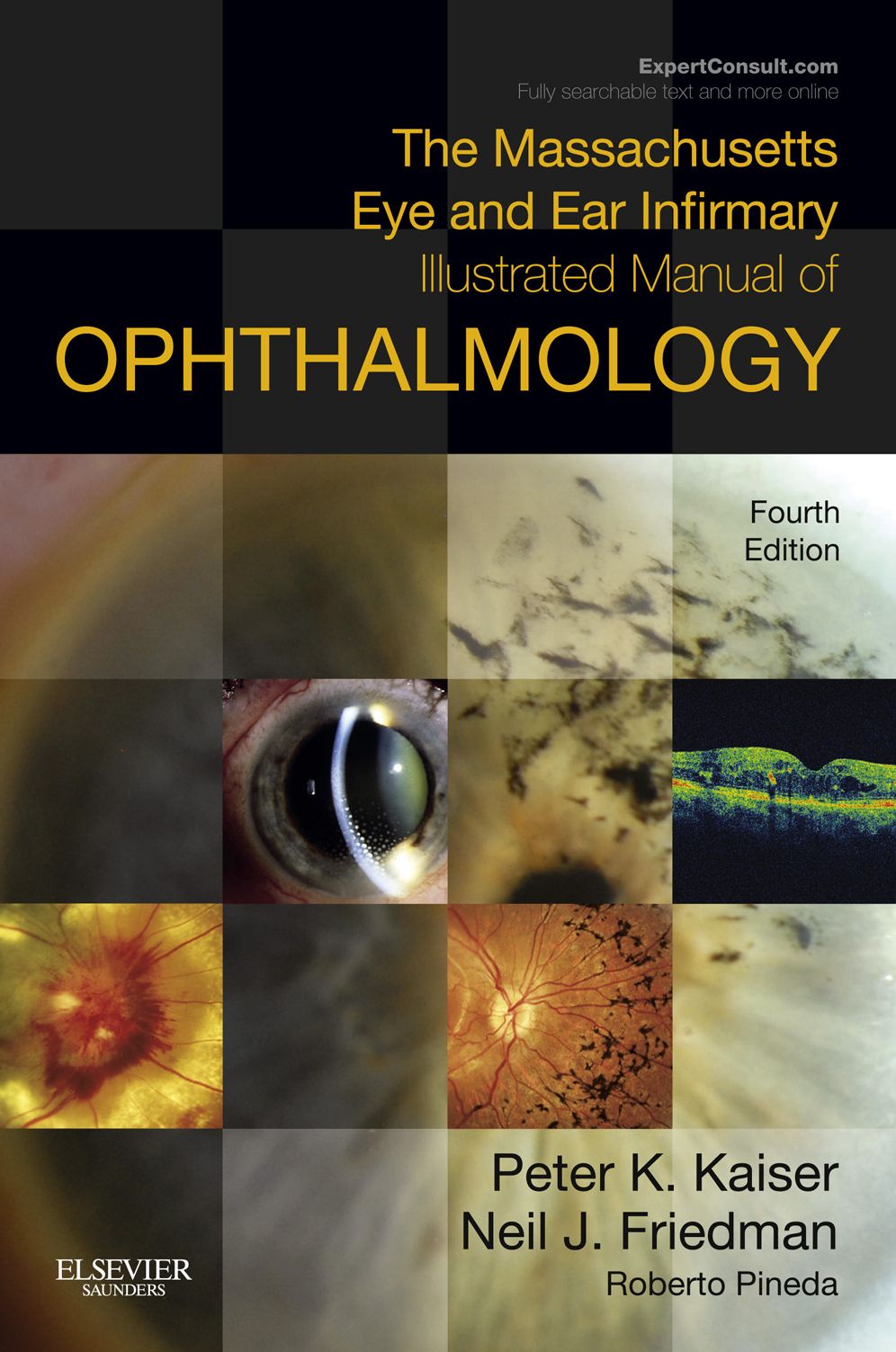 The Massachusetts Eye and Ear Infirmary Illustrated Manual of Ophthalmology E-Book