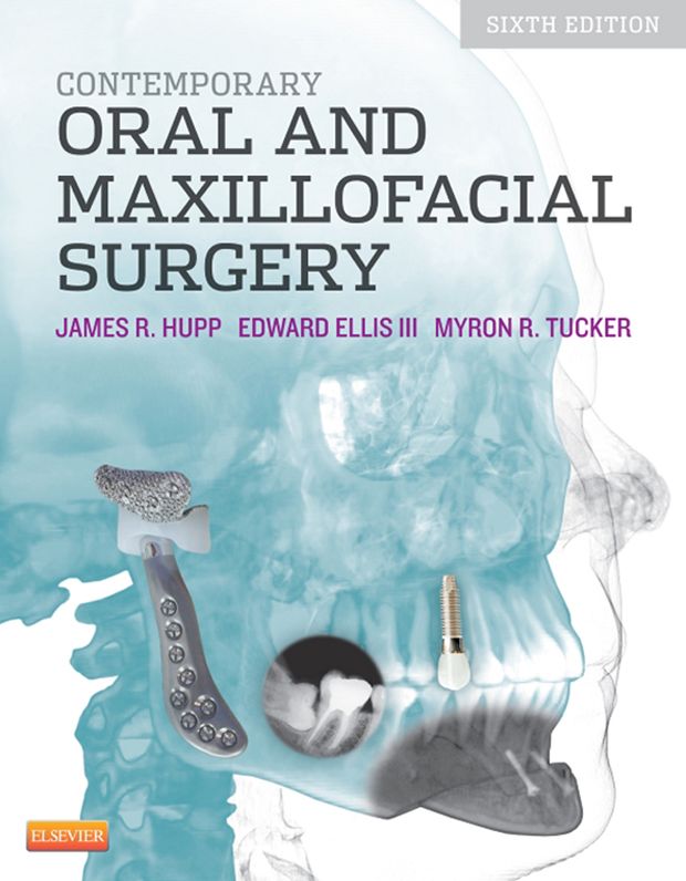 Contemporary Oral and Maxillofacial Surgery - E-Book