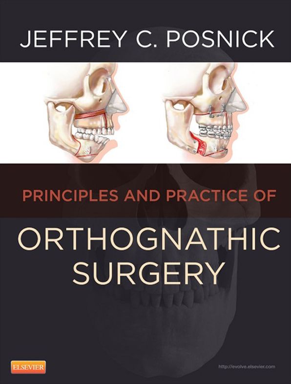 Orthognathic Surgery - E-Book: Principles and Practice