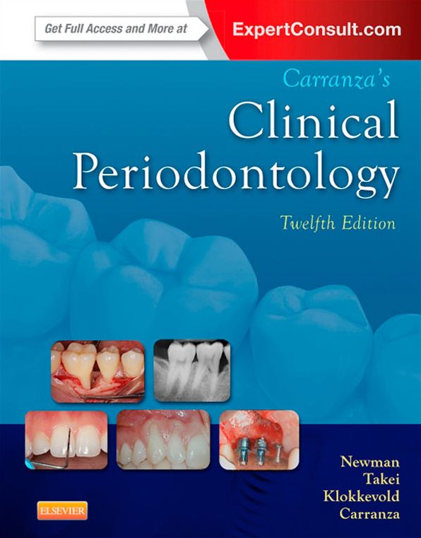 Carranza's Clinical Periodontology - E-Book: Expert Consult: Online