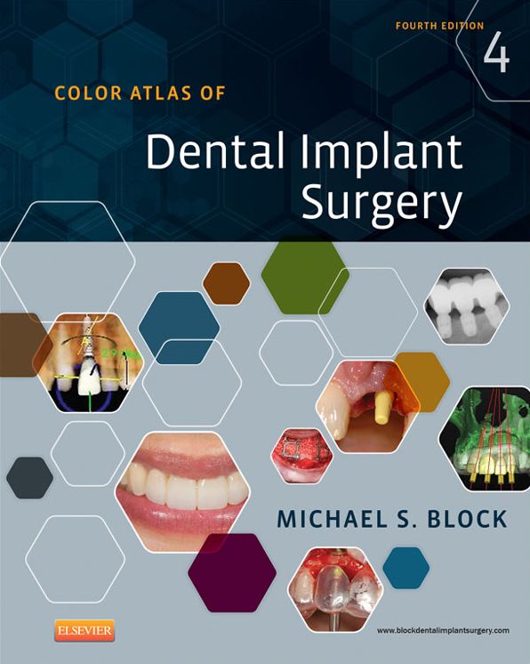Color Atlas of Dental Implant Surgery - E-Book