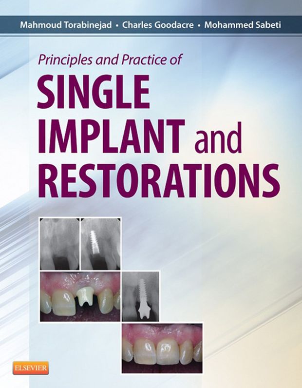 Principles and Practice of Single Implant and Restoration - E-Book