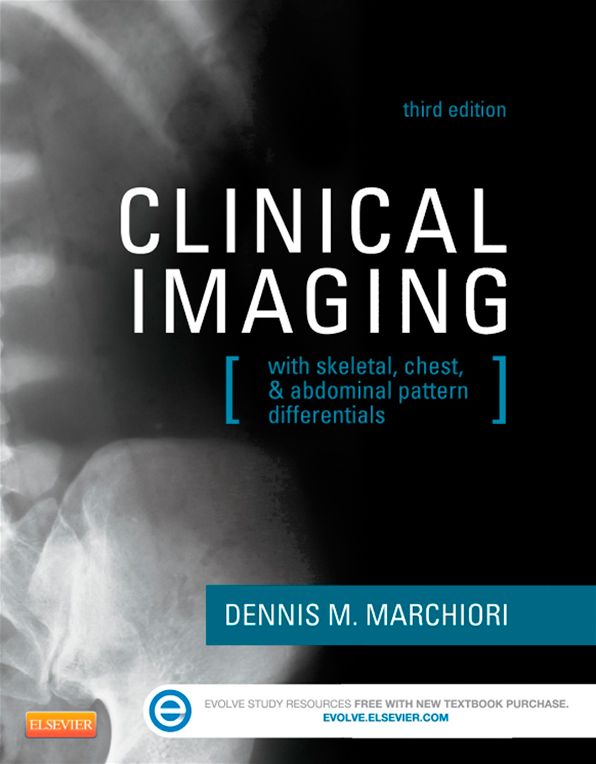 Clinical Imaging - E-Book: With Skeletal, Chest, & Abdominal Pattern Differentials