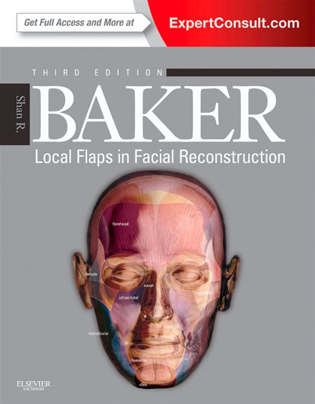 Local Flaps in Facial Reconstruction E-Book: Expert Consult