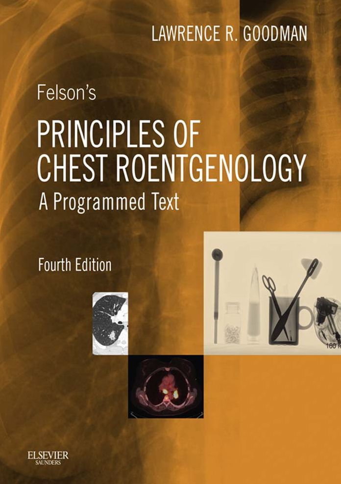 Felson's Principles of Chest Roentgenology E-Book