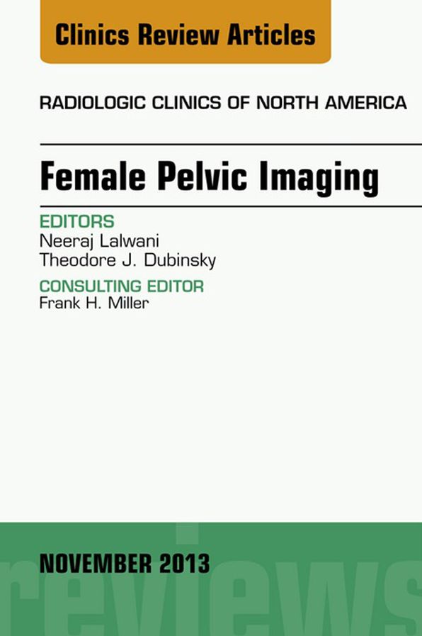 Female Pelvic Imaging, An Issue of Radiologic Clinics of North America, E-Book