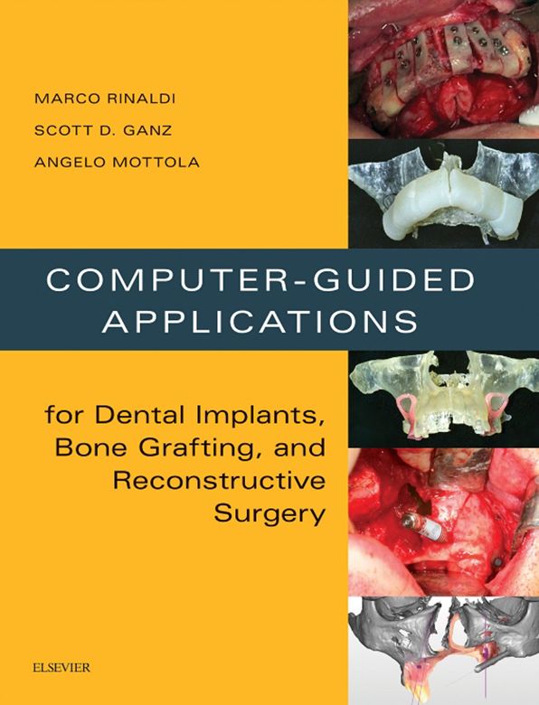 Computer-Guided Dental Implants and Reconstructive Surgery - E-Book: Clinical Applications