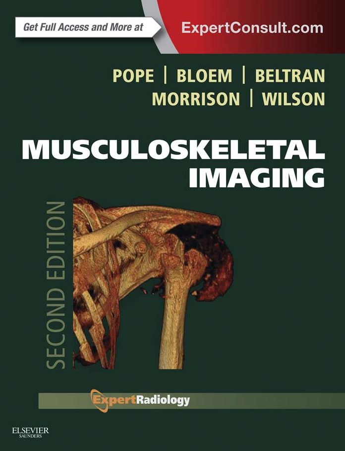 Musculoskeletal Imaging E-Book