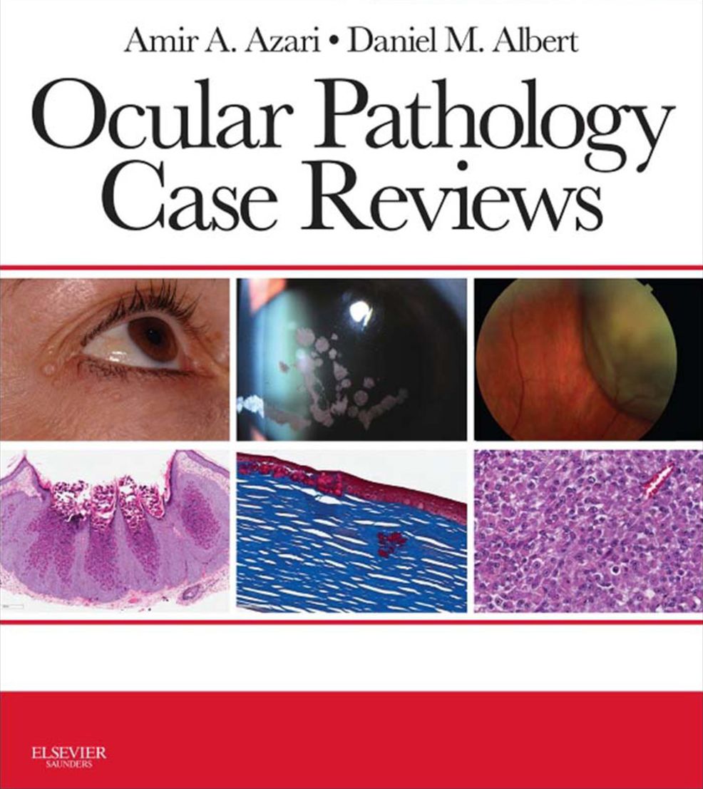 Ocular Pathology Case Reviews E-Book