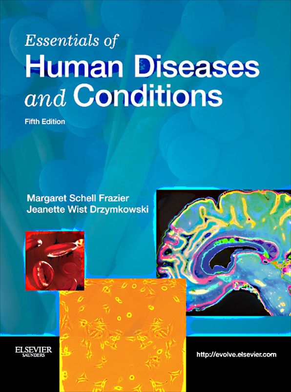 Essentials of Human Diseases and Conditions - E-Book