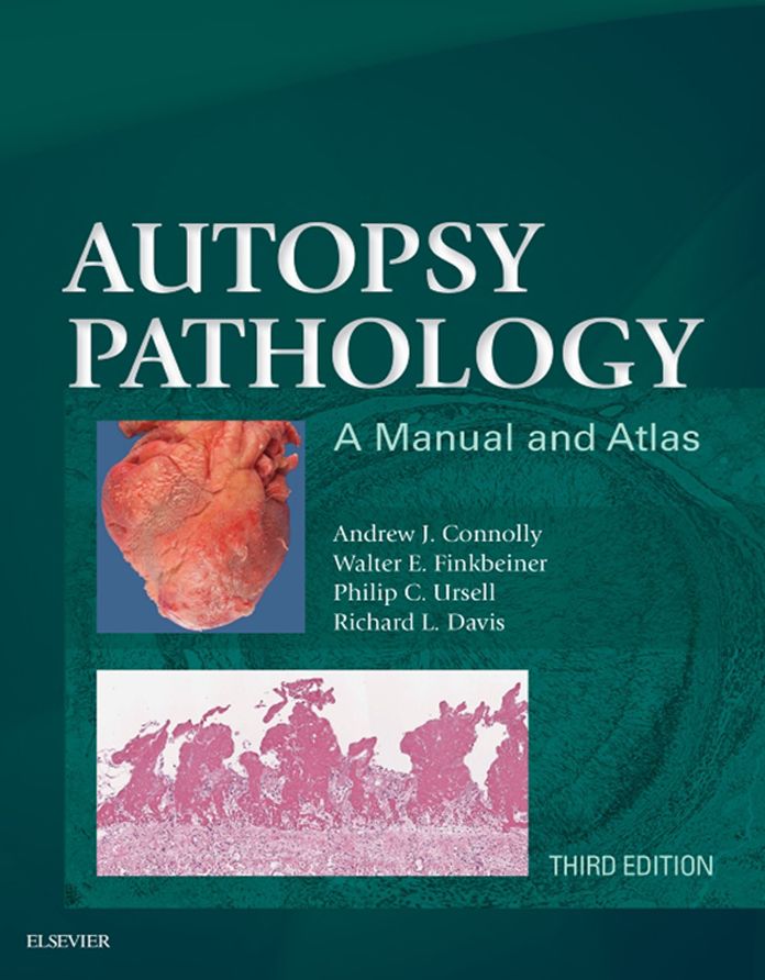 Autopsy Pathology: A Manual and Atlas E-Book