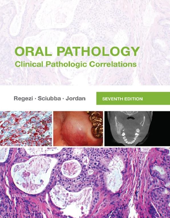 Oral Pathology - E-Book: Clinical Pathologic Correlations